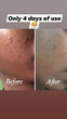 Turmeric Facial Kit